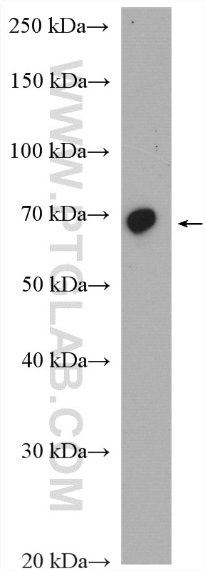 Western Blot (WB) analysis of mouse skeletal muscle tissue using Fibulin 5 Polyclonal antibody (12188-1-AP)