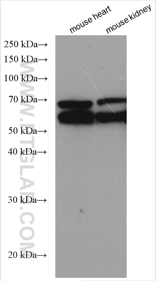 Western Blot (WB) analysis of various lysates using Fibulin 5 Polyclonal antibody (12188-1-AP)