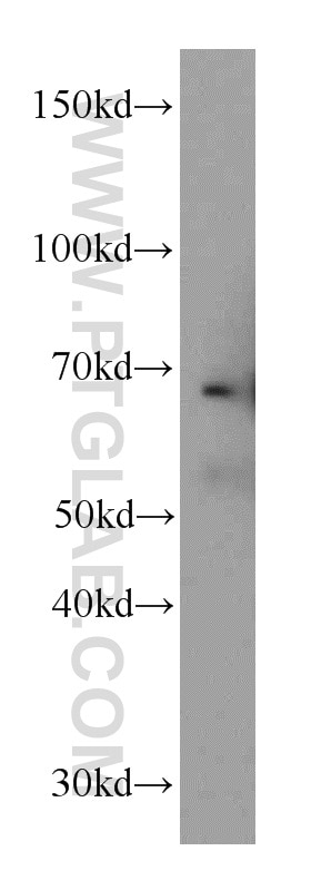 Fibulin 5 Polyclonal antibody