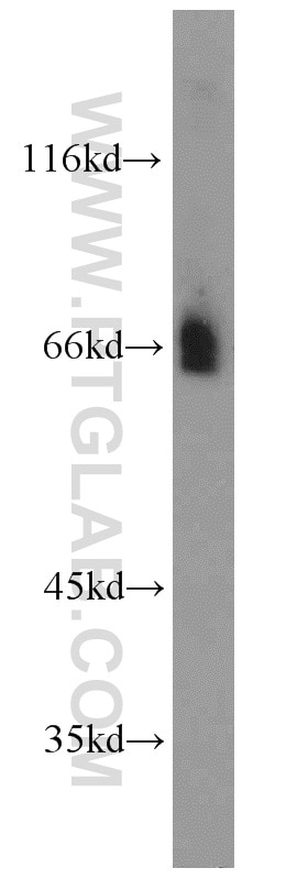 Western Blot (WB) analysis of rat brain tissue using Fibulin 5 Polyclonal antibody (12188-1-AP)