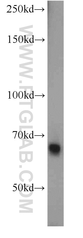 Western Blot (WB) analysis of mouse placenta tissue using Fibulin 5 Polyclonal antibody (12188-1-AP)