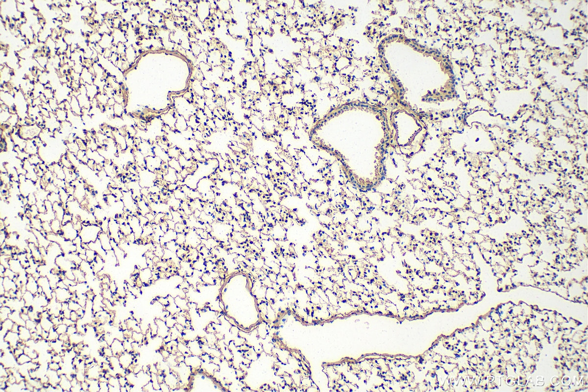 Immunohistochemistry (IHC) staining of mouse lung tissue using Fibulin 5 Polyclonal antibody (29992-1-AP)