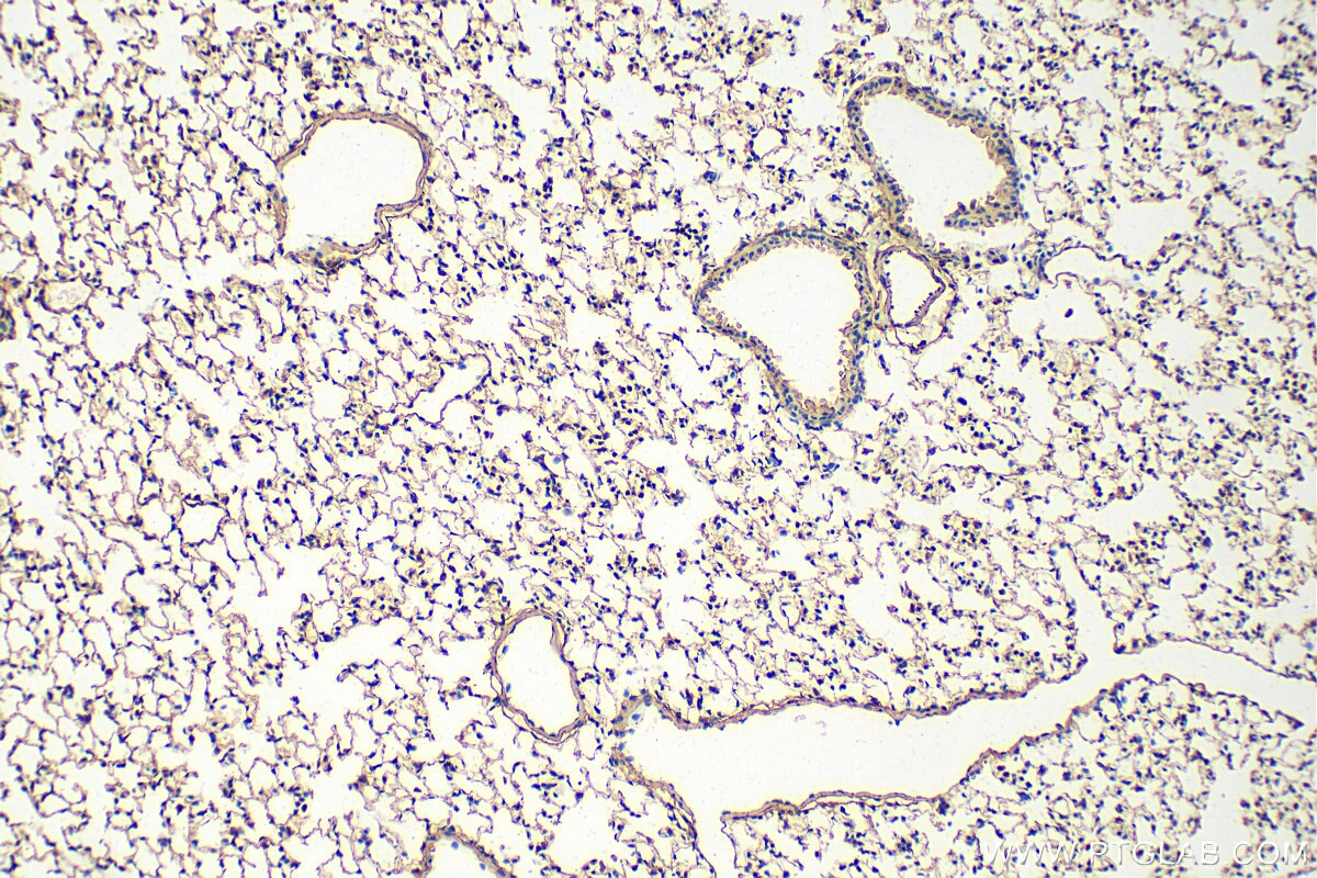 Immunohistochemistry (IHC) staining of mouse lung tissue using Fibulin 5 Polyclonal antibody (29992-1-AP)