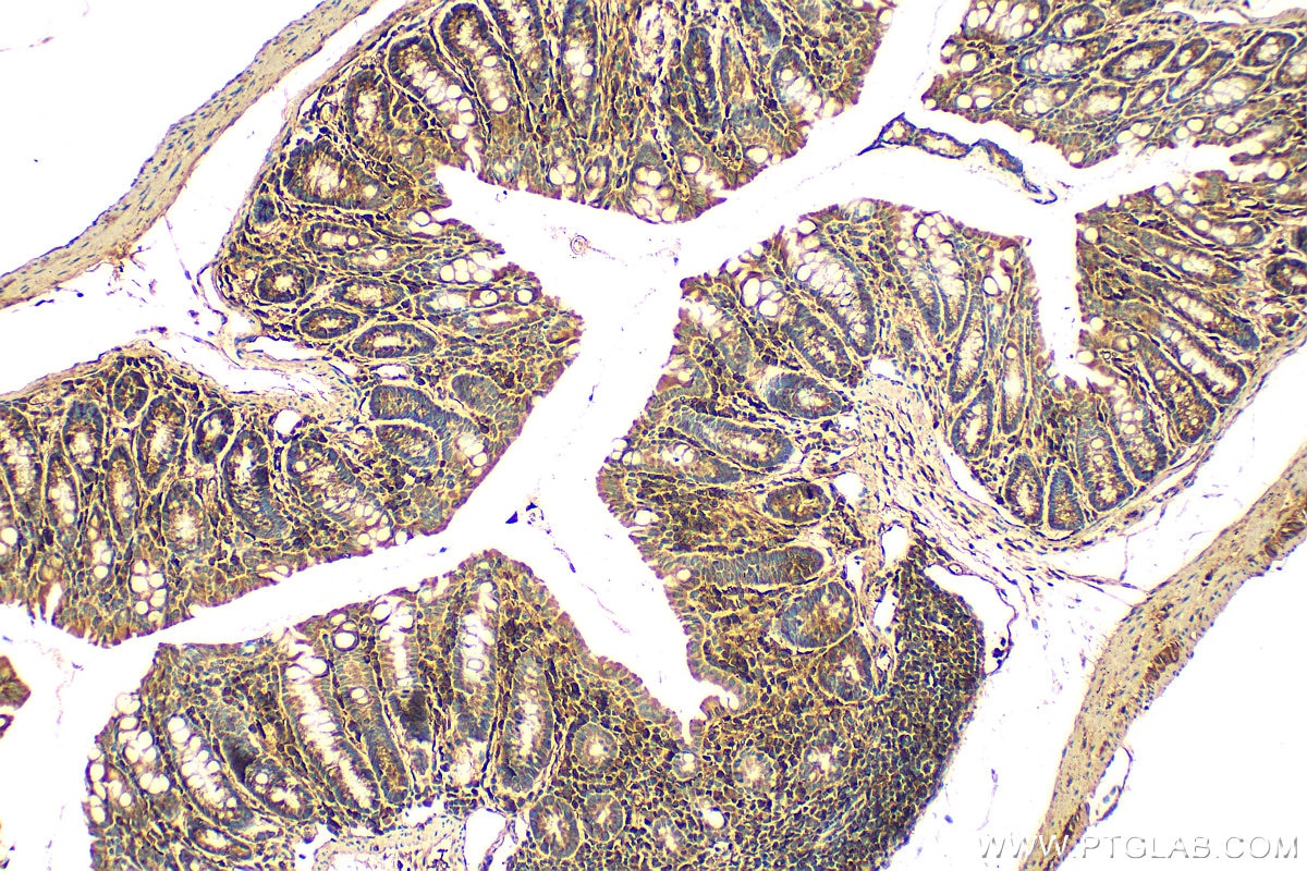 Immunohistochemistry (IHC) staining of mouse colon tissue using Fibulin 5 Polyclonal antibody (29992-1-AP)