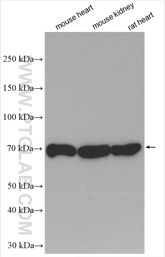 Western Blot (WB) analysis of various lysates using Fibulin 5 Polyclonal antibody (29992-1-AP)
