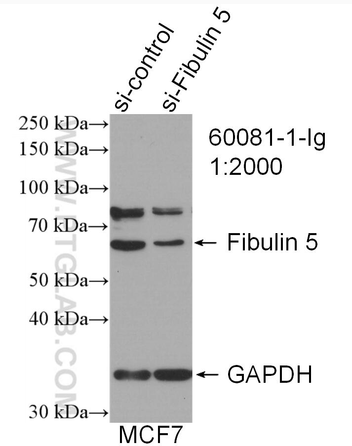 WB analysis of MCF-7 using 60081-1-Ig