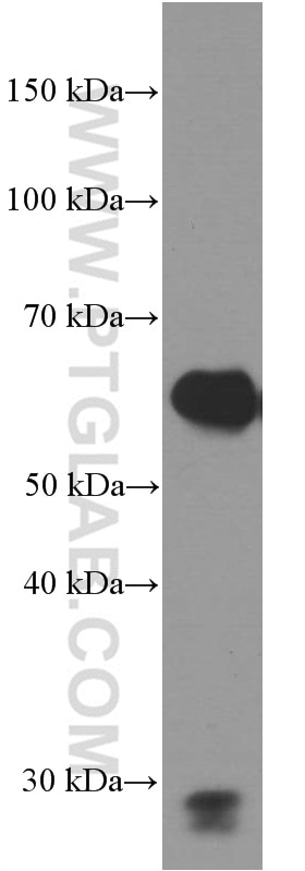 Western Blot (WB) analysis of human placenta tissue using Fibulin 5 Monoclonal antibody (60081-1-Ig)