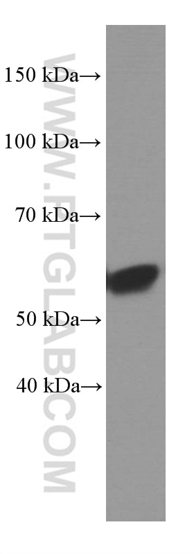 Western Blot (WB) analysis of human heart tissue using Fibulin 5 Monoclonal antibody (60081-1-Ig)