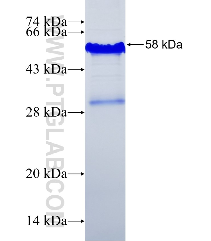 FBLN5 fusion protein Ag30835 SDS-PAGE