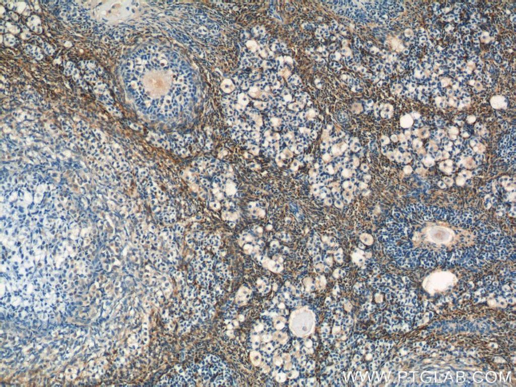 Immunohistochemistry (IHC) staining of human ovary tissue using FBN1-Specific Polyclonal antibody (20251-1-AP)