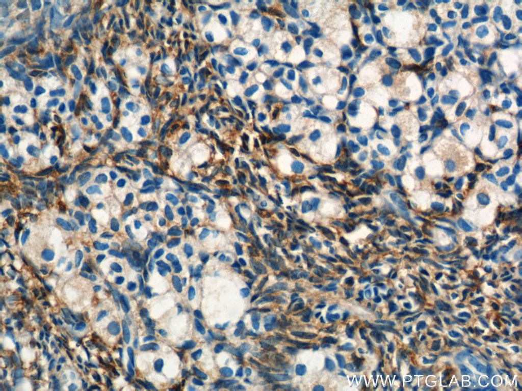 Immunohistochemistry (IHC) staining of human ovary tissue using FBN1-Specific Polyclonal antibody (20251-1-AP)