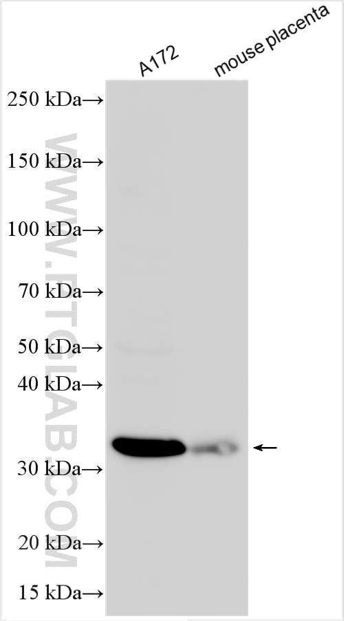 Western Blot (WB) analysis of various lysates using Asprosin Polyclonal antibody (20251-1-AP)