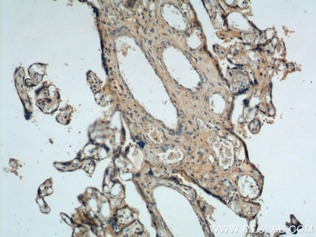 Immunohistochemistry (IHC) staining of human placenta tissue using fibrillin 2-Specific Polyclonal antibody (20252-1-AP)