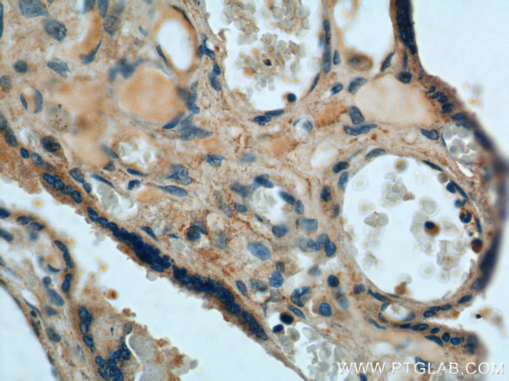 IHC staining of human placenta using 20252-1-AP