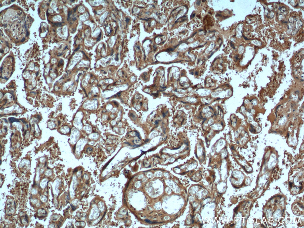 Immunohistochemistry (IHC) staining of human placenta tissue using fibrillin 2-Specific Polyclonal antibody (20252-1-AP)