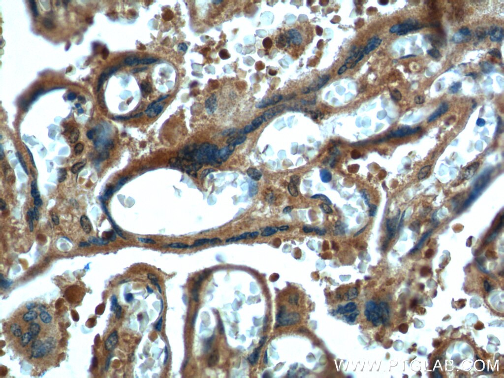 Immunohistochemistry (IHC) staining of human placenta tissue using fibrillin 2-Specific Polyclonal antibody (20252-1-AP)