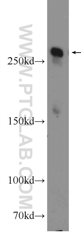 Western Blot (WB) analysis of mouse lung tissue using fibrillin 2-Specific Polyclonal antibody (20252-1-AP)