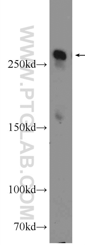 WB analysis of mouse lung using 20252-1-AP