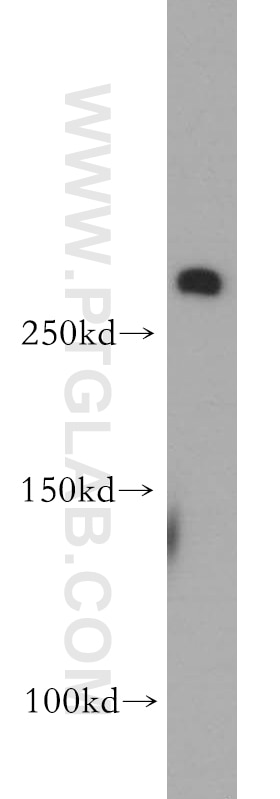 Western Blot (WB) analysis of human brain tissue using fibrillin 2-Specific Polyclonal antibody (20252-1-AP)