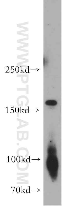 Western Blot (WB) analysis of human brain tissue using fibrillin 2-Specific Polyclonal antibody (20252-1-AP)