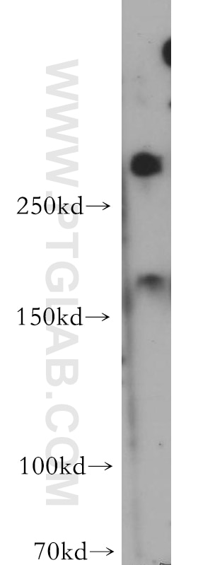 Western Blot (WB) analysis of HepG2 cells using fibrillin 2-Specific Polyclonal antibody (20252-1-AP)