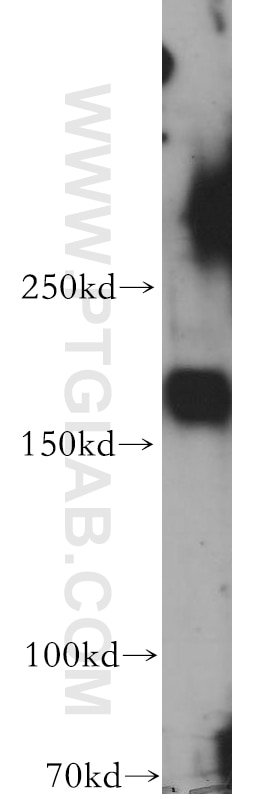 Western Blot (WB) analysis of HepG2 cells using fibrillin 2-Specific Polyclonal antibody (20252-1-AP)
