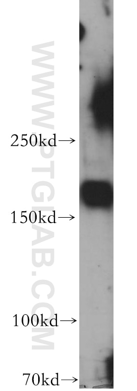 WB analysis of HepG2 using 20252-1-AP