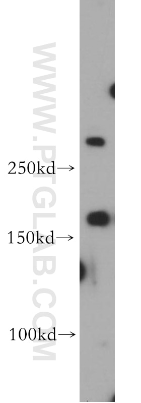 Western Blot (WB) analysis of L02 cells using fibrillin 2-Specific Polyclonal antibody (20252-1-AP)