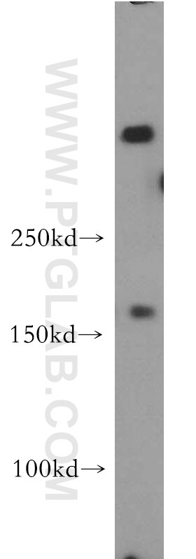 Western Blot (WB) analysis of L02 cells using fibrillin 2-Specific Polyclonal antibody (20252-1-AP)