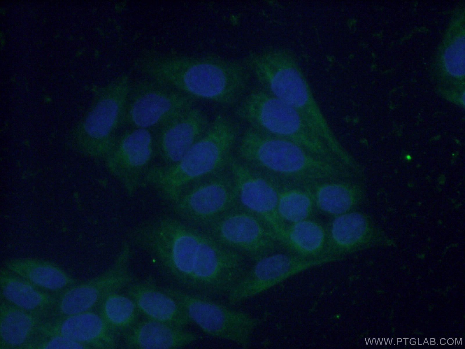 Immunofluorescence (IF) / fluorescent staining of HeLa cells using FBP1 Polyclonal antibody (12842-1-AP)