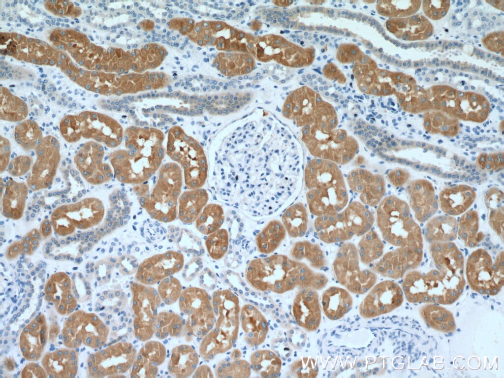 Immunohistochemistry (IHC) staining of human kidney tissue using FBP1 Polyclonal antibody (12842-1-AP)