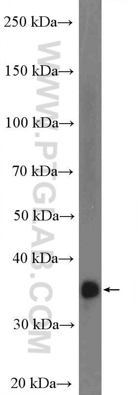 FBP1 Polyclonal antibody