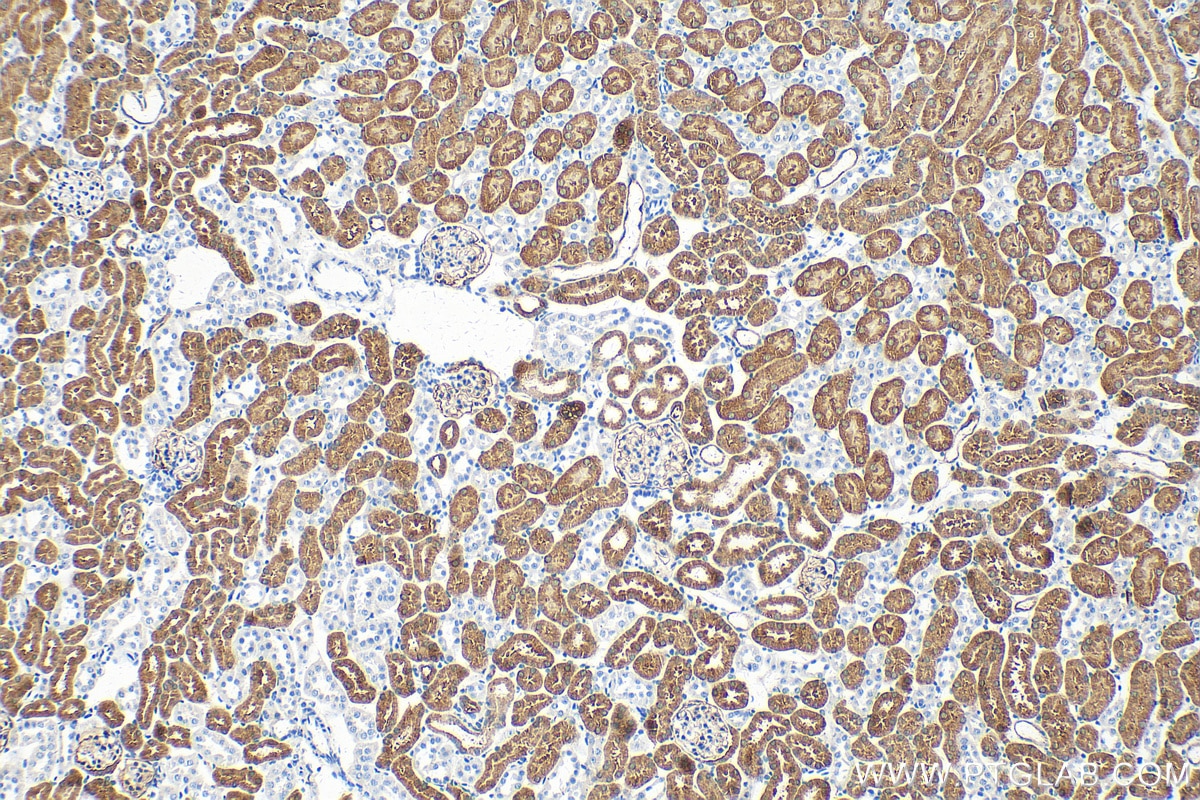 Immunohistochemistry (IHC) staining of mouse kidney tissue using FBP1 Monoclonal antibody (68446-1-Ig)