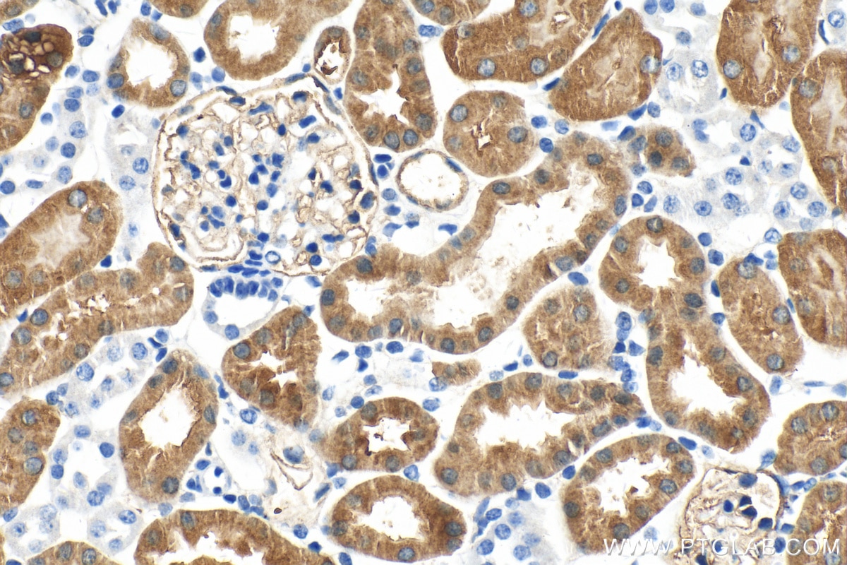 Immunohistochemistry (IHC) staining of mouse kidney tissue using FBP1 Monoclonal antibody (68446-1-Ig)