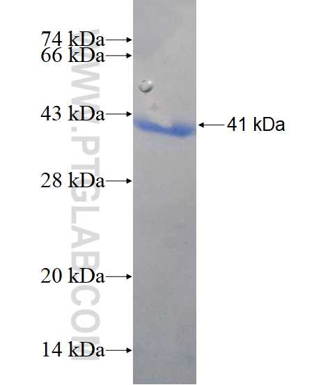 FBP1 fusion protein Ag3837 SDS-PAGE