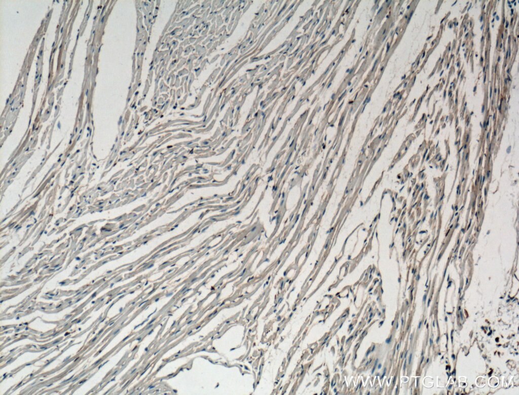 Immunohistochemistry (IHC) staining of mouse heart tissue using FBP17 Polyclonal antibody (27056-1-AP)