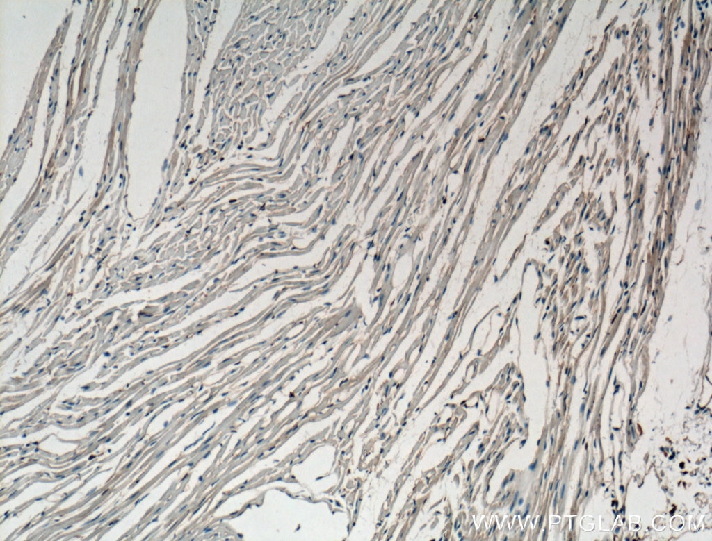 IHC staining of mouse heart using 27056-1-AP