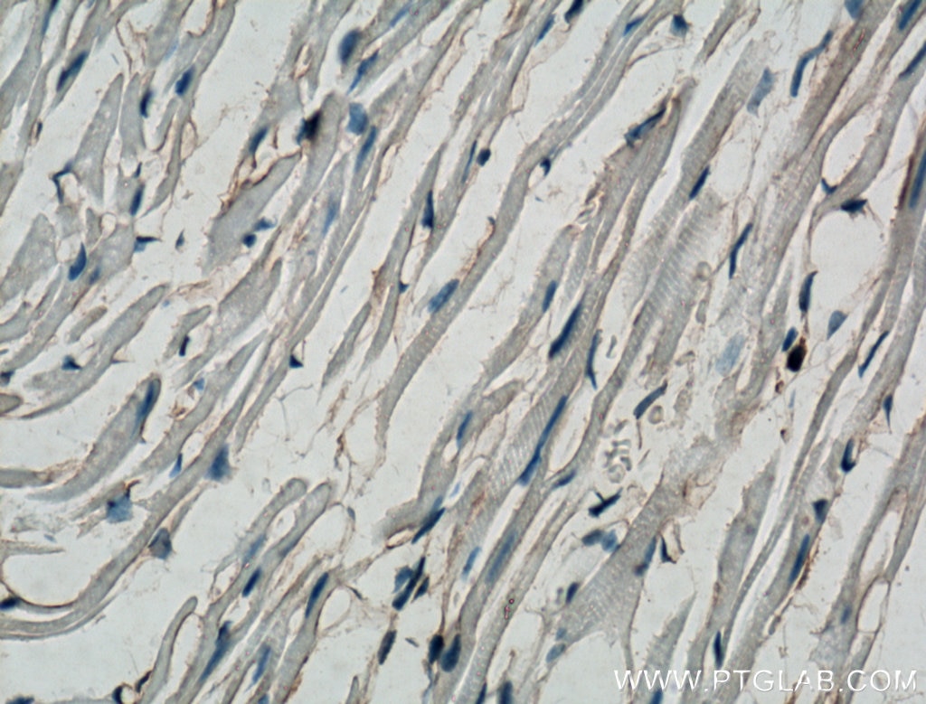 IHC staining of mouse heart using 27056-1-AP