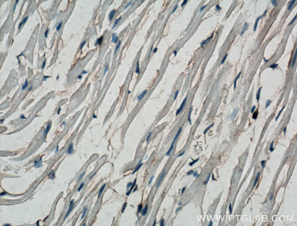 Immunohistochemistry (IHC) staining of mouse heart tissue using FBP17 Polyclonal antibody (27056-1-AP)