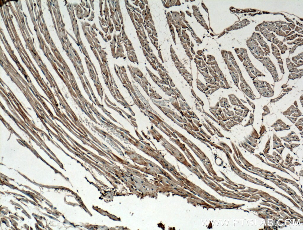 Immunohistochemistry (IHC) staining of mouse heart tissue using FBP17 Polyclonal antibody (27056-1-AP)