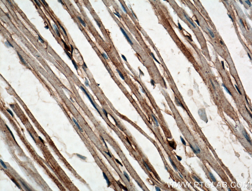 Immunohistochemistry (IHC) staining of mouse heart tissue using FBP17 Polyclonal antibody (27056-1-AP)