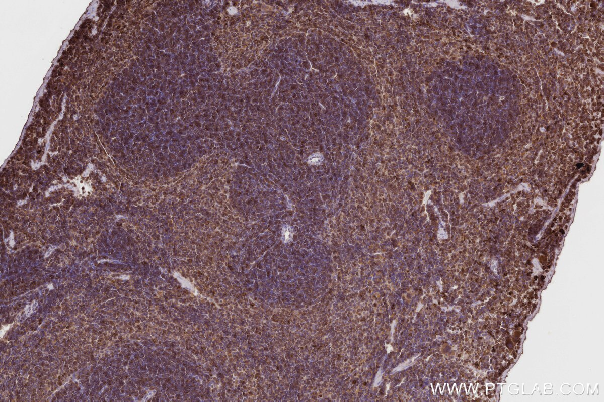 Immunohistochemistry (IHC) staining of mouse spleen tissue using FBP17 Polyclonal antibody (27056-1-AP)