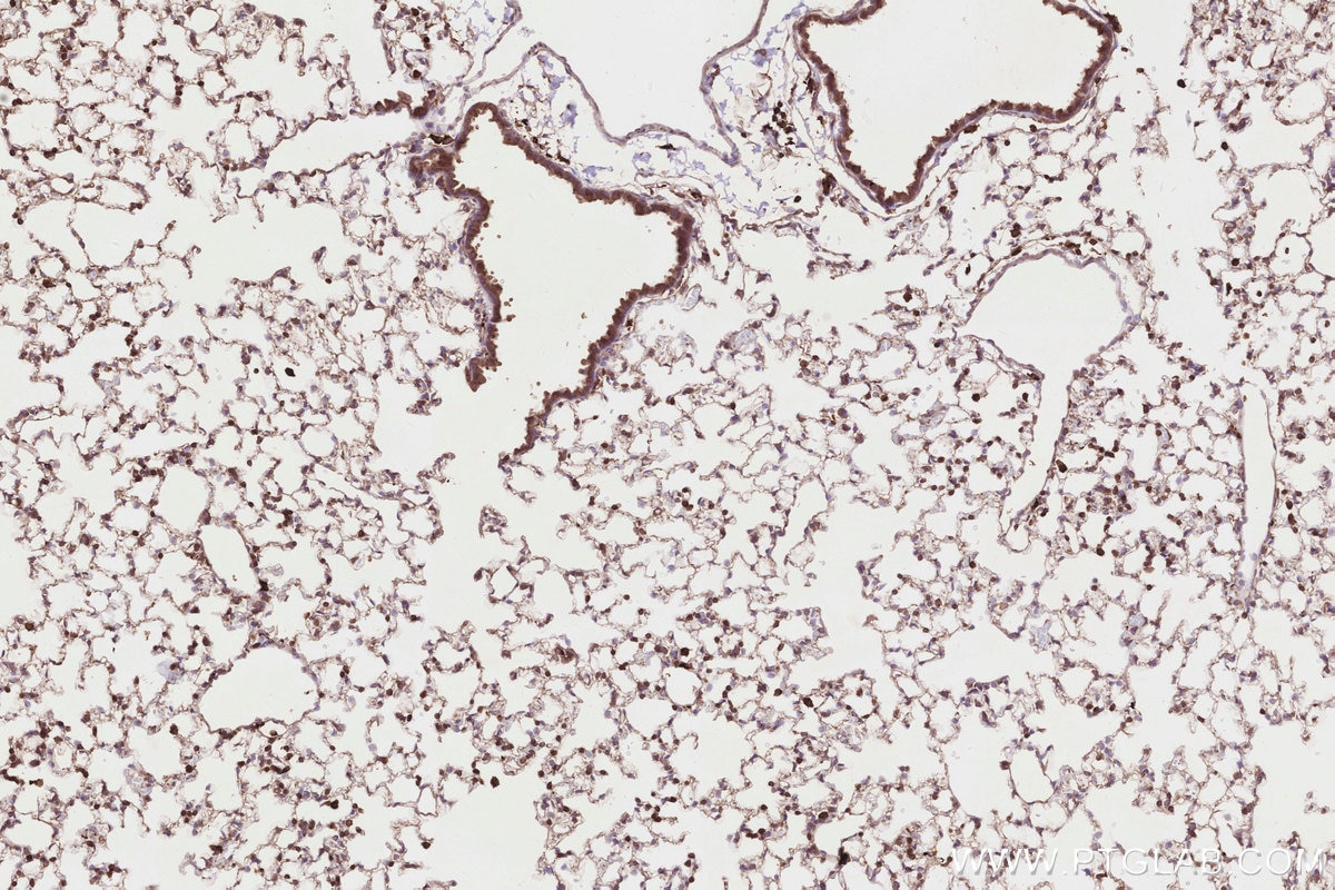 Immunohistochemistry (IHC) staining of mouse lung tissue using FBP17 Polyclonal antibody (27056-1-AP)
