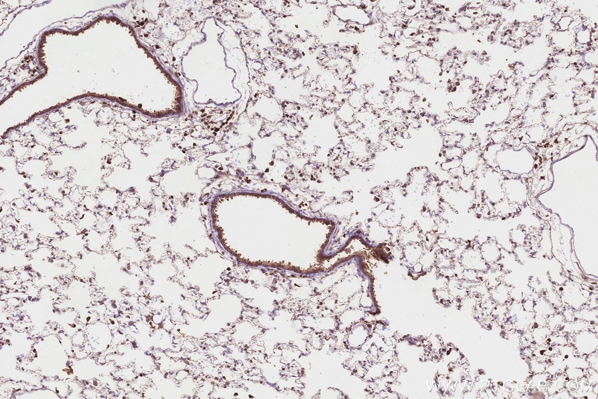 Immunohistochemistry (IHC) staining of rat lung tissue using FBP17 Polyclonal antibody (27056-1-AP)