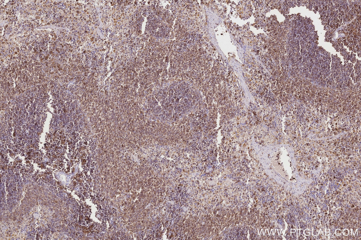 Immunohistochemistry (IHC) staining of rat spleen tissue using FBP17 Polyclonal antibody (27056-1-AP)