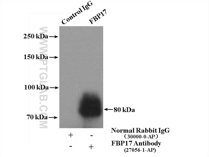 Immunoprecipitation (IP) experiment of mouse brain tissue using FBP17 Polyclonal antibody (27056-1-AP)