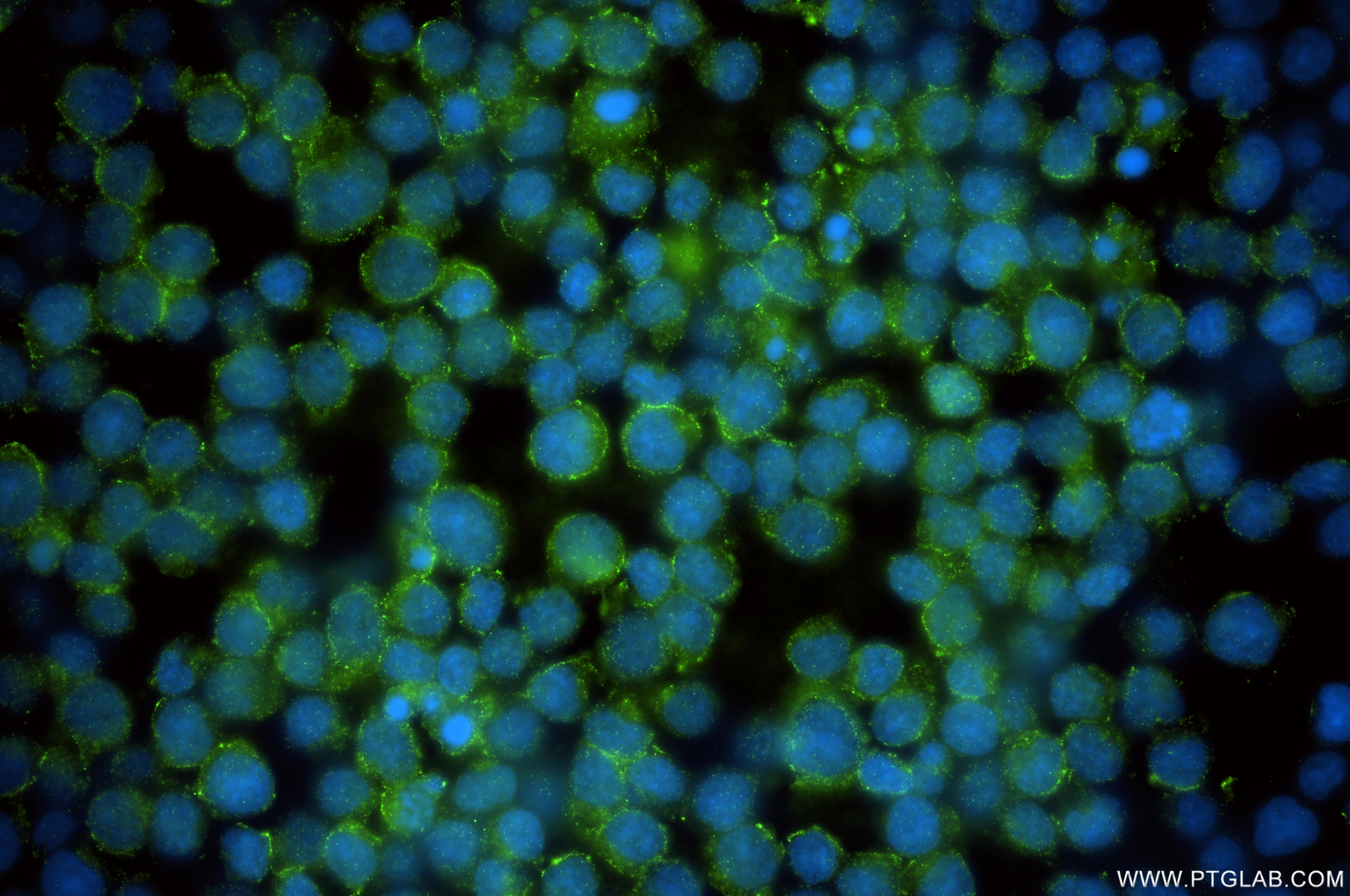 Immunofluorescence (IF) / fluorescent staining of Jurkat cells using FBP17 Recombinant monoclonal antibody (86852-2-RR)