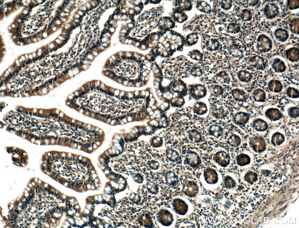 IHC staining of human small intestine using 25192-1-AP