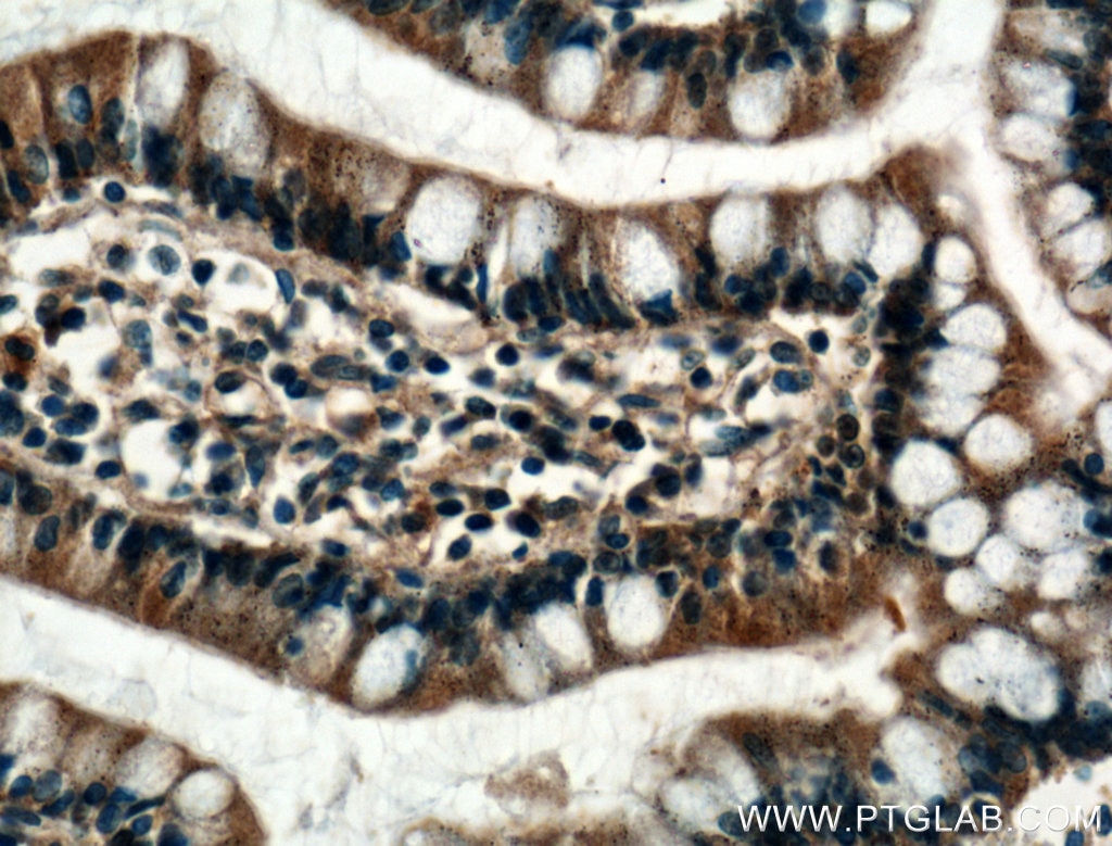Immunohistochemistry (IHC) staining of human small intestine tissue using FBP2 Polyclonal antibody (25192-1-AP)