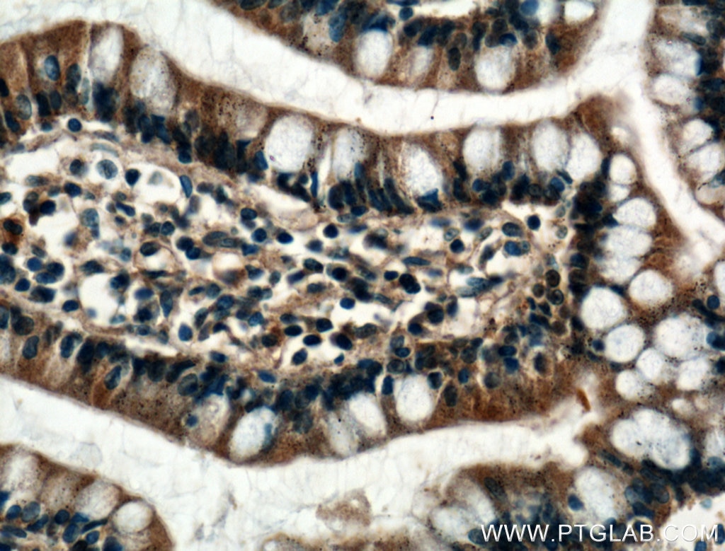 IHC staining of human small intestine using 25192-1-AP